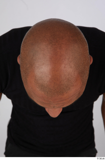 Photos Tiago bald head 0006.jpg